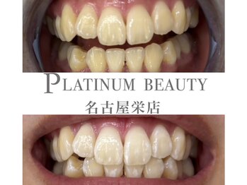 プラチナムビューティー 名古屋栄本店(PLATINUM BEAUTY)/お客様Before After