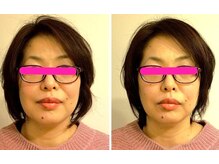 美顔サロン モーイ(mooi)