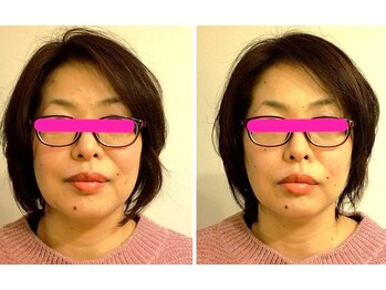 美顔サロン モーイ(mooi)