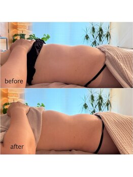 ニコテ(Nicote)/臓活リンパボディ