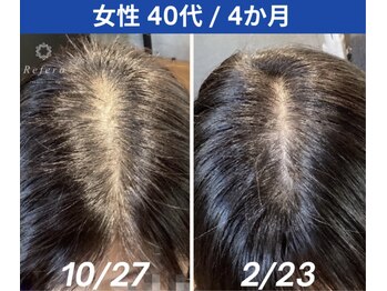 リフェロ 豊橋店(Refero)/Refero４本使用変化