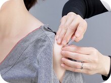 刺激・痛みの少ない優しいはりで、辛い箇所に集中アプローチ◎