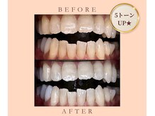 ルセホワイト 室蘭登別(LUCE WHITE)/