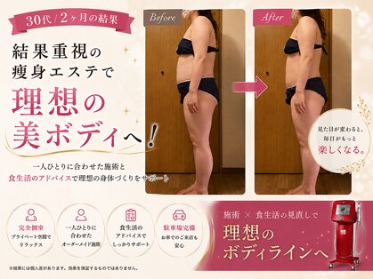 ラナン(Ranan)の写真