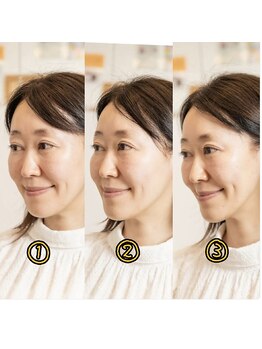 北梅田美容鍼灸院/【大阪/梅田】ビフォーアフター