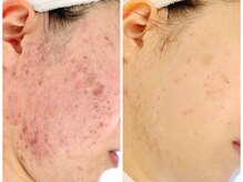 アロマビューティーサロン ジェイハウス(J)/