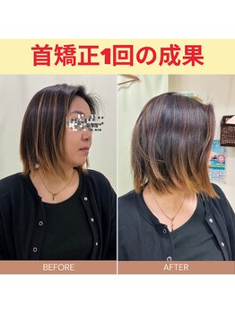 永田東洋鍼灸整骨院/骨格矯正で軽々動く首を肩を♪