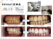 ホワイトニングサロンブライト 尼崎店(Whitening salon bright)