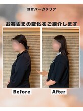 ヨサパーク メリア(YOSA PARK MERIA)/巻き肩、猫背解消！初回施術効果