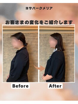 ヨサパーク メリア(YOSA PARK MERIA)/巻き肩、猫背解消！初回施術効果