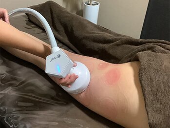 青空 チクシノサロン(SORA CHIKUSHINO SALON)/気になるお腹/太もも集中ケア#2