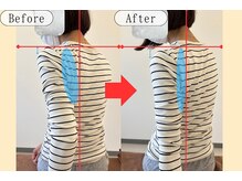 シェアハピネス たまプラーザ(share happiness)/Before＆After