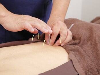 シャローム鍼灸院の写真/肩こり・頭痛・眼精疲労・美容まで、ツボ刺激で巡りを整える。東洋医学の知恵で心身にアプローチします◎