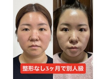 リアプア(Li'a)/3ヵ月で別人級変化!効果実感◎