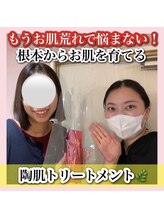 アルムダアクア 天王寺店(Aleumda AQUA)/ハーブピーリング/大阪/天王寺