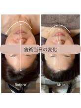 ルーツ(Roots)/エステ