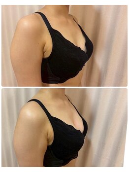 レイビス 仙台店(RAYVIS)/ふわふわマシュマロバスト3