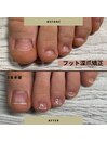 足の深爪！！