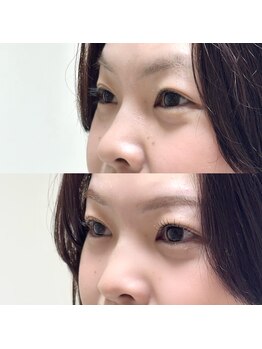 ビョル(byeol)の写真/《四条駅/まつげパーマ》まつげパーマで上向きまつ毛をキープ!朝の時短にも◎