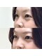 ビョル(byeol)の写真/《四条駅/まつげパーマ》まつげパーマで上向きまつ毛をキープ!朝の時短にも◎