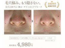 オレオマ(OLEOMA)