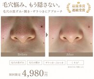 オレオマ(OLEOMA)