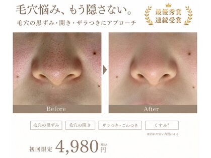 オレオマ(OLEOMA)の写真