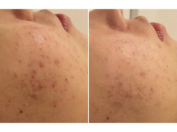 ミュレア 新宿本店(mulea)/【サーマトリックス】