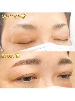 アンドミラ(&mira)/ハリウッドブロウリフト