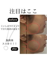 エミング(yeming)/★美禅筋骨小顔トリートメント★