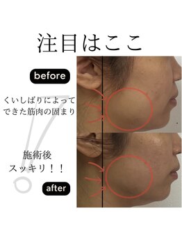 エミング(yeming)/★美禅筋骨小顔トリートメント★
