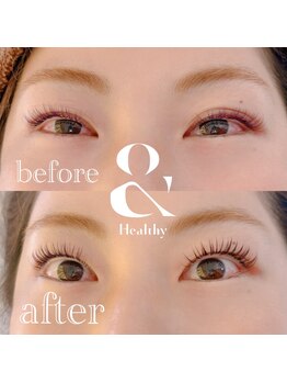 ジーニー(Genie)/カラーアンドヘルシー