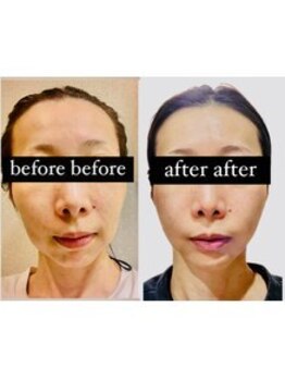 サロン ド カリナン(salon de Cullinan)/お顔の歪みもメソッドで解消