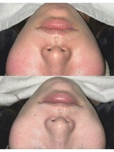 エクリル(Eclire)/クリスティーナ