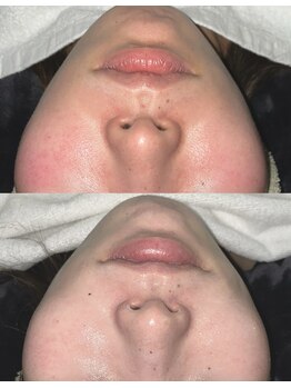 エクリル(Eclire)/クリスティーナ