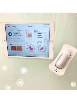 ポーラ エステ亜由美店(POLA)/肌分析3