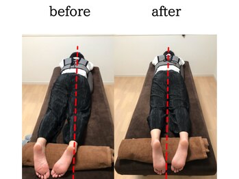 村岡整体院/骨盤の捻れ続出!!