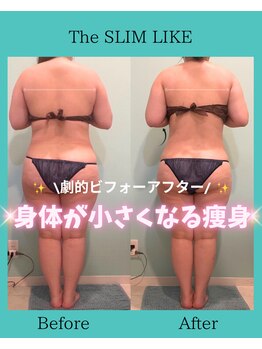 スリムライク 鳥取店(The SLIM LIKE)/痩身ビフォーアフター