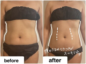 つばききよら/１度でお腹がスッキリ！縦ライン