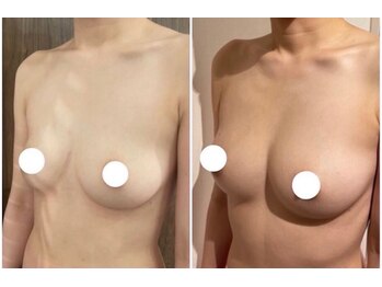 ラディス(Radice.)/デコルテからふっくら！バストUP