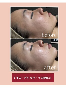 えすて処 灯香/