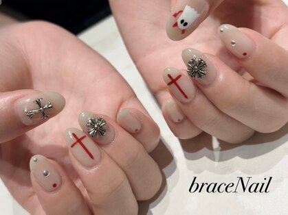 ブレスネイル(brace Nail)の写真