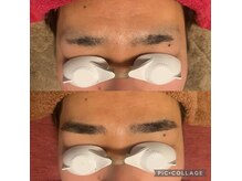 人気の髭脱毛以外も眉脱毛が人気◎手入れ不要に。11年の実績