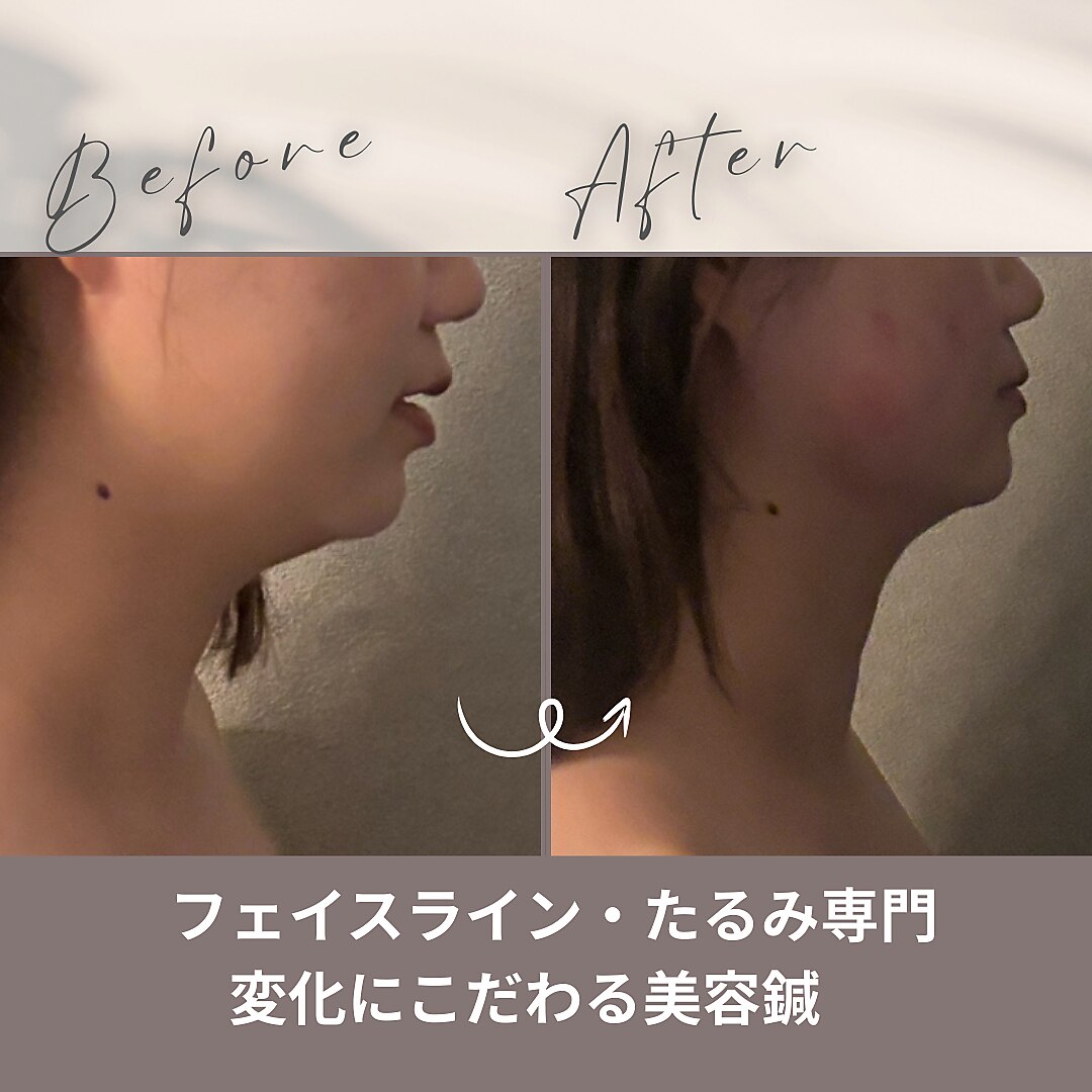 ハチハチ(808)｜ホットペッパービューティー