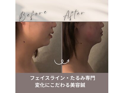 ハチハチ(808)の写真