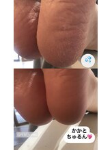 プティットスリール 西尾店(Petit Sourire)/【フット角質ケア】