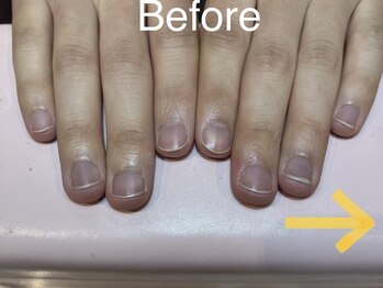 アンドネイル 海老名(&nail)/最強ネイルケア★Before