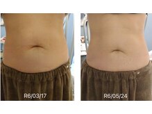 ルアナ(Luana)/寝ているだけでスリムに♪