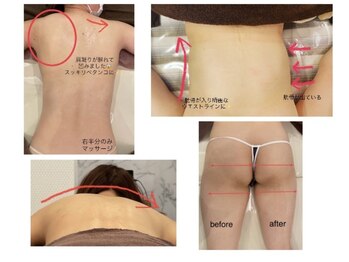 レーヴ(Reve)/肩こり解消/巻肩/痩身/肋骨締め