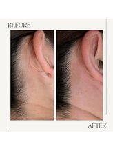 スプランドゥール(Splendeur)/レディース【うなじ】 &nbsp;Wax＋光